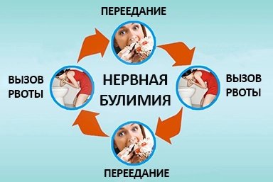 Лечение булимии в Аскизе